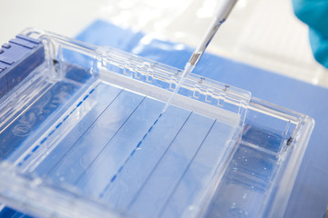 loading a sample into a gel for electrophoresis
