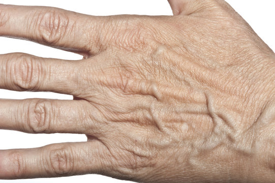 Wrinkled Woman Skin On Hand