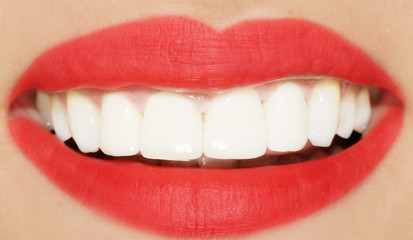 Laughing woman smile with great teeth
