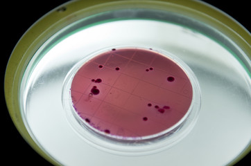 Placa de cultivo de bacterias