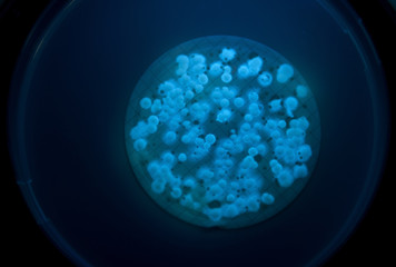 bacterias pseudomona aeruginosa