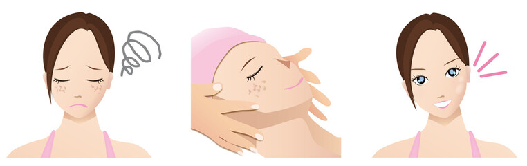 エステシミ対策