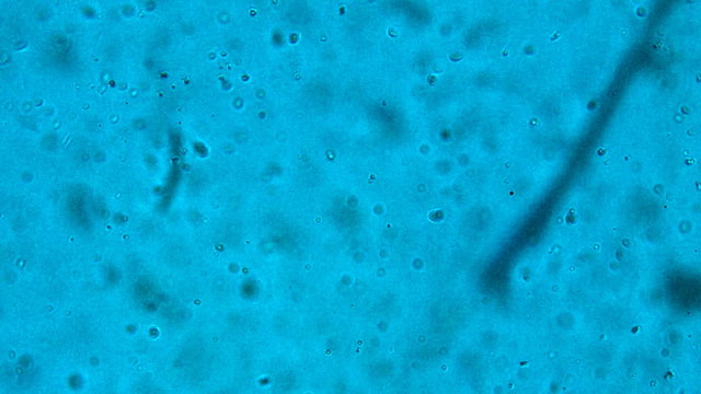 virus and bacteria from a microscope