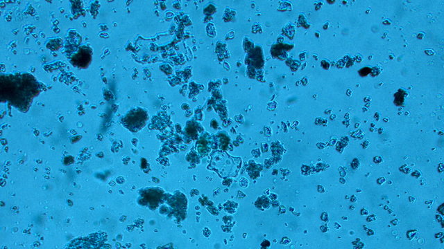 virus and bacteria from a microscope