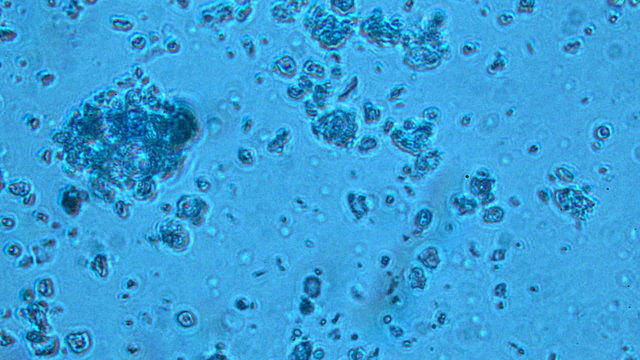 virus and bacteria from a microscope