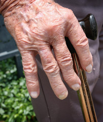 Hand of old man with arthritis supported with walking stick