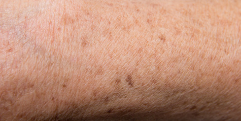 Fototapeta premium spots on the hand of her grandmother as a background