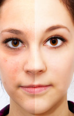 Beauty face - before and after