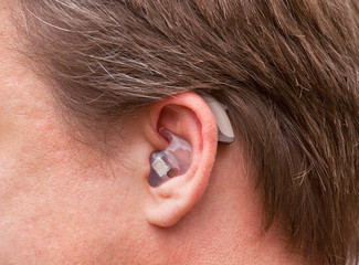 Close-up of a man ear with hearing aid