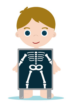 x ray check bones kid