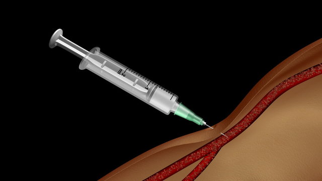 Hypodermic syringe injects substance into an arm.