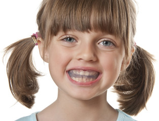 little girl with plastic braces isolated on white © Vera Kuttelvaserova