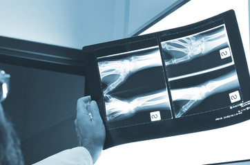 Medico radiografia