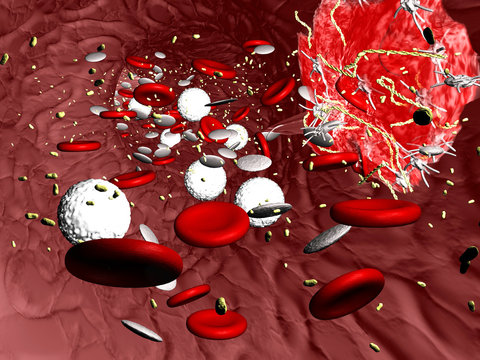 Blood Vessel - Thrombus III