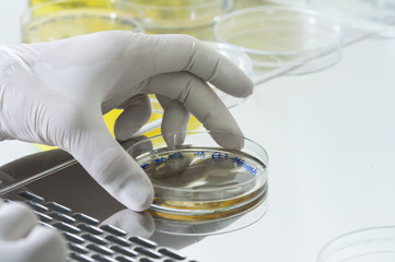 Manos de científico con placas de cultivo de bacterias