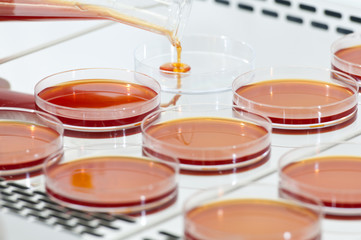 Placas de cultivo de bacterias rojas