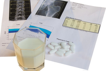 Photograph of DXA osteoporosis diagnosis against white