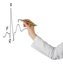 drawing ECG