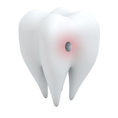 3D human tooth with hole isolated