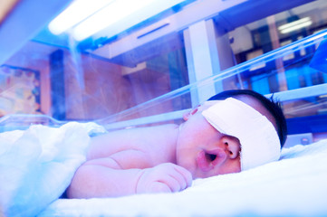 Newborn Under Ultraviolet Light