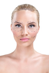 woman whose face is marked with lines for facial cosmetic surger