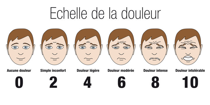 &eacute;chelle de la douleur gradu&eacute;e de 1 &agrave; 10, montrant l'expression d'un visage grima&ccedil;ant suivant l'intensit&eacute; de la souffrance qu'il subit