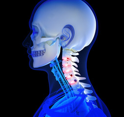 Human Neck pain focusing on area's of pain