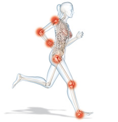 Painful osteoarthritic joints of a woman, medically 3D illustration.jpg
