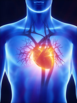 X-ray cardiovascular system