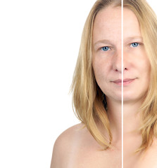 before / after image of a woman