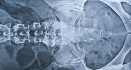 Lower back X-ray including coxis. Female.