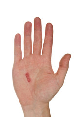 Callus on the male hand