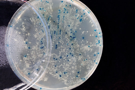 a Petri Dish with growing Virus and bacteria cells. microorganis