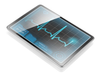 Tablet displaying ECG