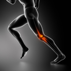 Sports knee injury x-ray concept