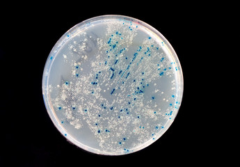 a Petri Dish with growing Virus and bacteria cells. microorganis