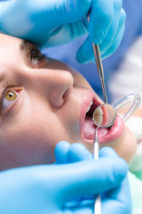 Dentist surgery closeup of woman's open mouth