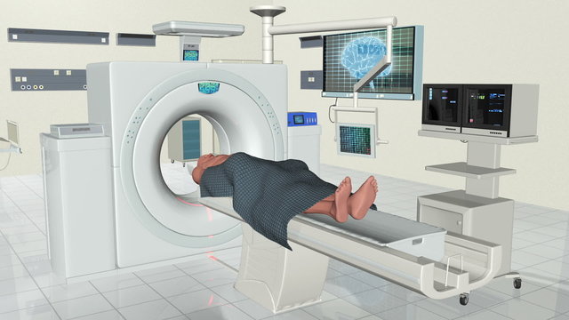 MRI Human Brain Scan