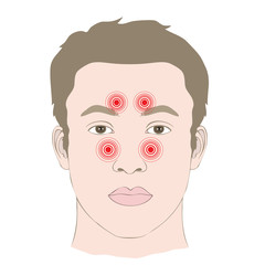 headache, disease sinus infection