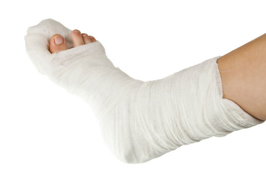 Leg In A Plaster Isolated