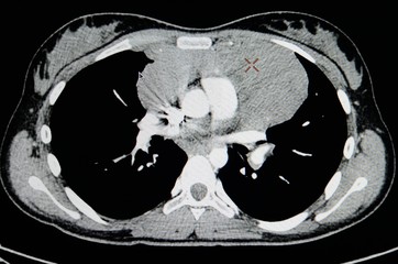 MRI scan of human body