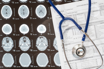 Medical report and stethoscope lying over x-ray