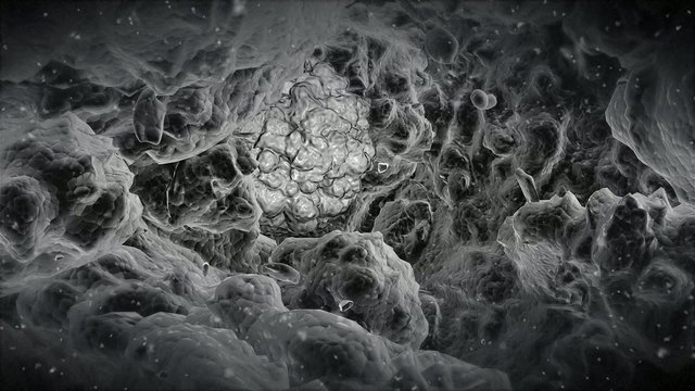 Electron microscope view at the alien virus.