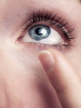 Kontaktlinse wird von Optiker aufgrund Sehschw&auml;che in Auge eingesetzt