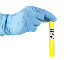 Test tube labeled Human