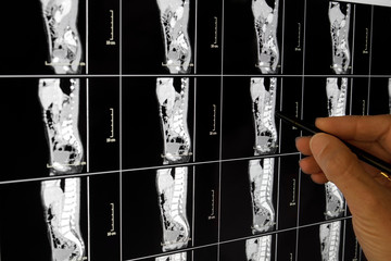 Medical Xray Diagnosis