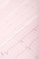 ECG chart (electrocardiogram)