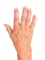 Hand of an old woman with arthritis, isolated on white