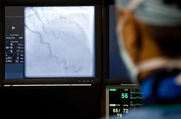 Doctor observing angiography machine