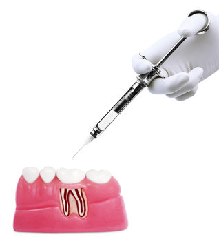 Dental treatment